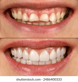 全面解析射手网播放器的功能与使用技巧